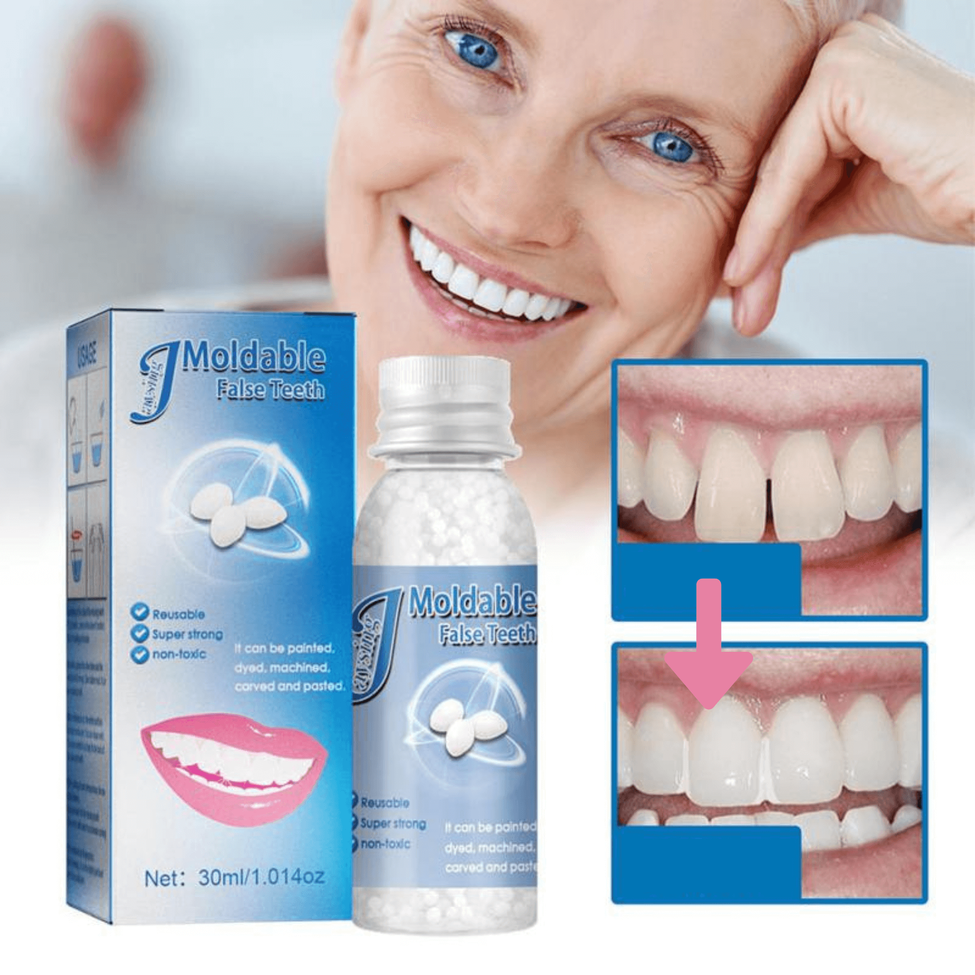 Moldable Temporary Dental Repair Beads