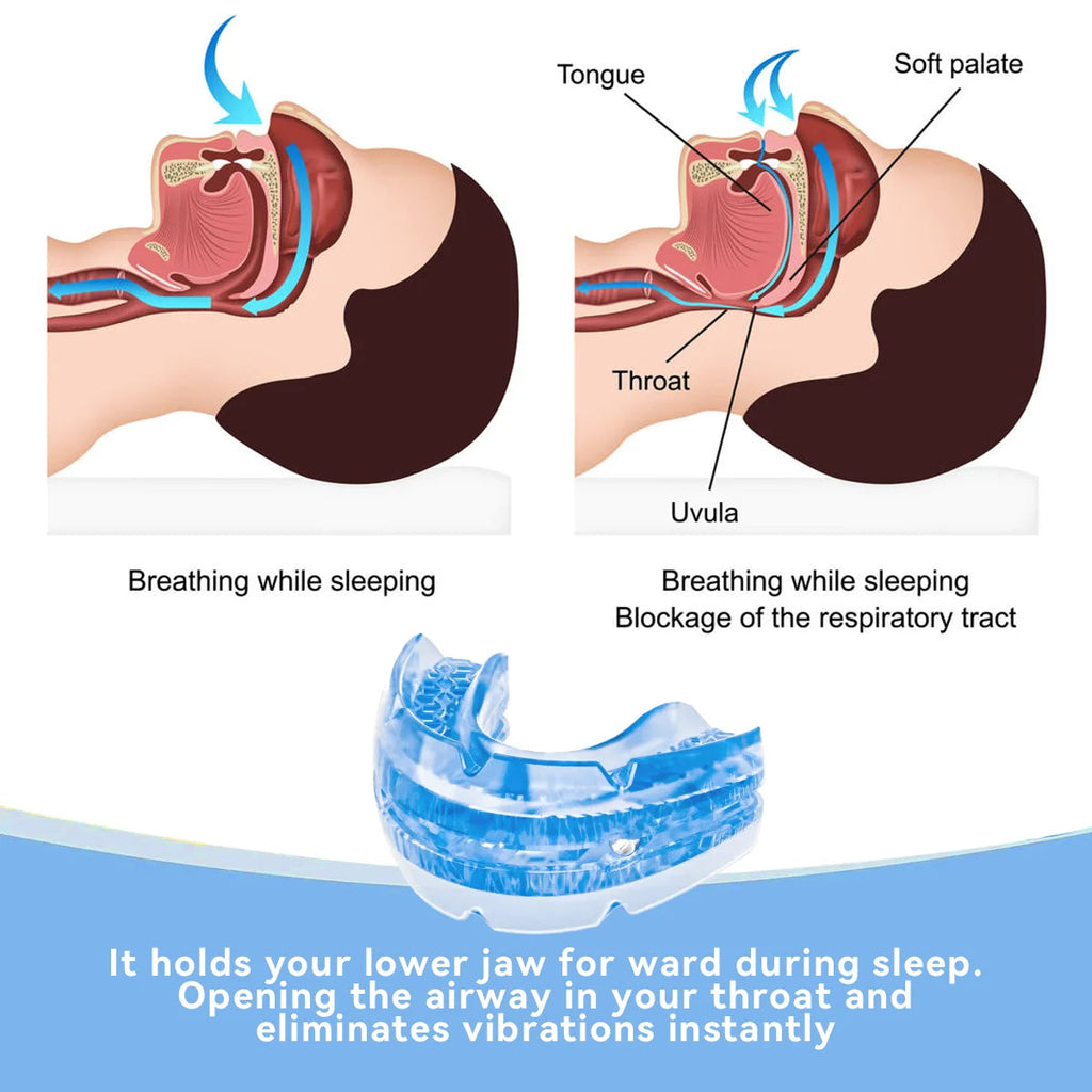 Sisica | BPA-Free Anti-Snore Dental Guard for Better Sleep