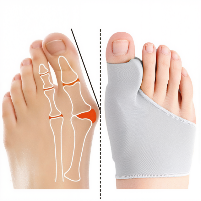 Sisica | Bunion Corrector with Gel Pad Support