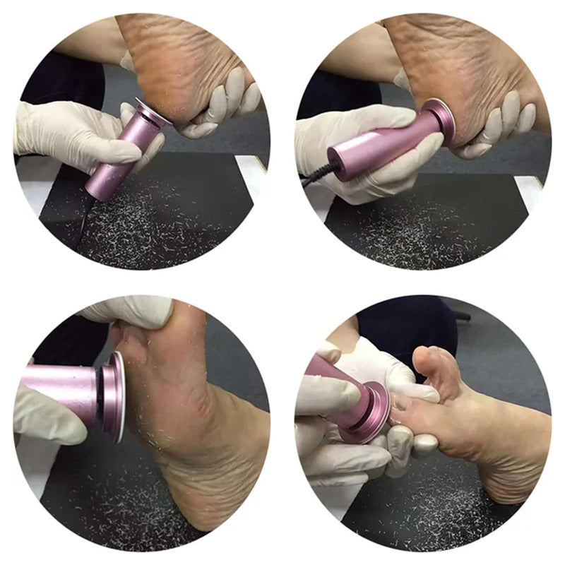 Sisica | Electric Foot Callus Remover with Adjustable Speed