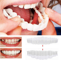 Charly | On Smile Veneers (Upper and Lower Jaw included)
