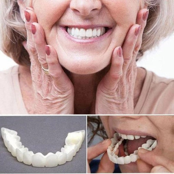 Sisica | On Smile Veneers (Upper and Lower Jaw included)