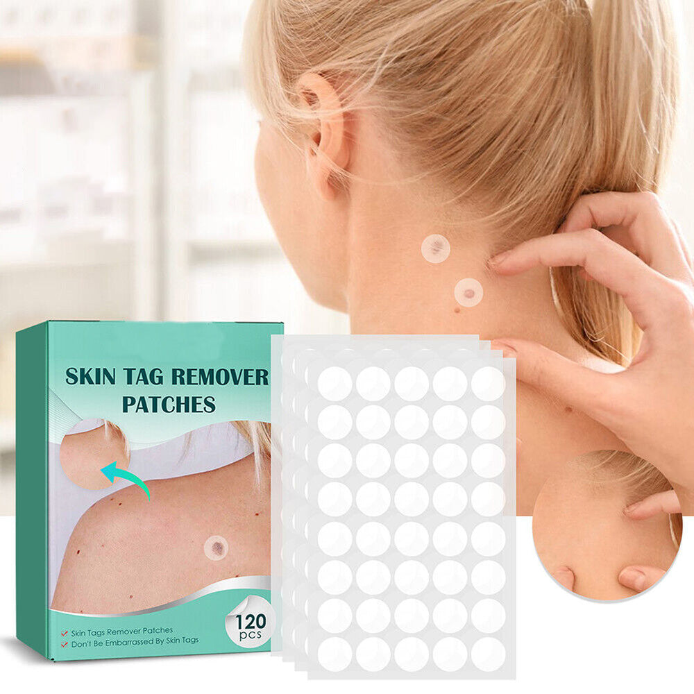 Sisica | SkinClear Skin Tag Remover | Plaster for the Removal of Skin Tags & Warts | Hydrocolloid Technology | Pain-Free & Discreet | Suitable for All Skin Types | 144 Pieces
