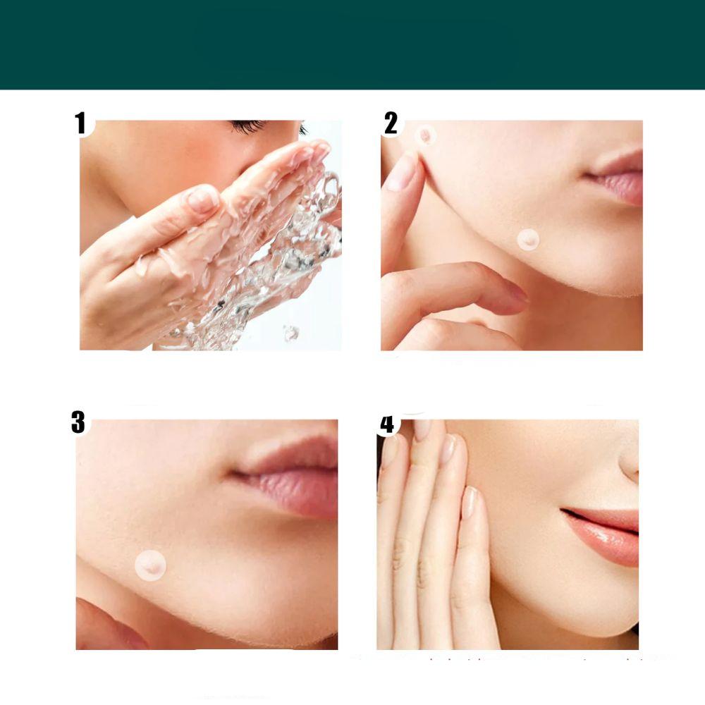 Sisica | SkinClear Skin Tag Remover | Plaster for the Removal of Skin Tags & Warts | Hydrocolloid Technology | Pain-Free & Discreet | Suitable for All Skin Types | 144 Pieces