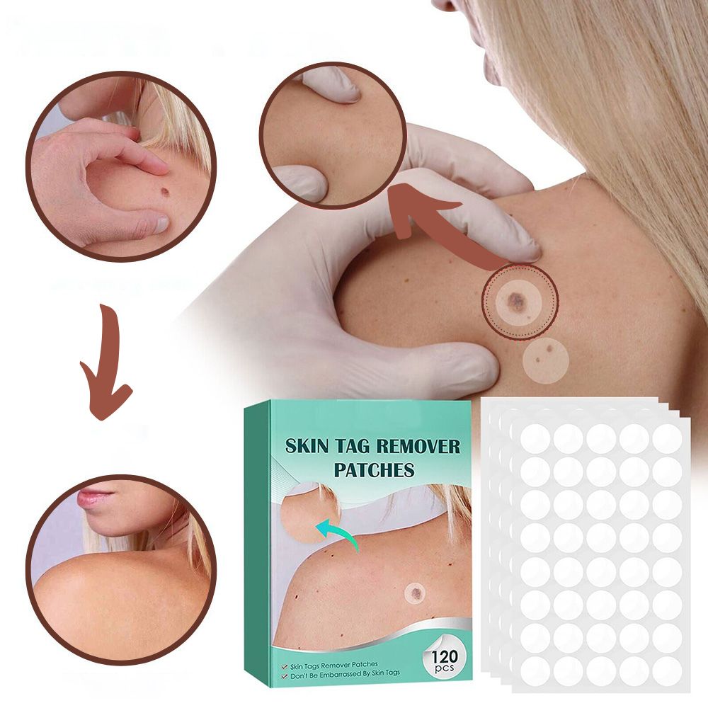 Sisica | SkinClear Skin Tag Remover | Plaster for the Removal of Skin Tags & Warts | Hydrocolloid Technology | Pain-Free & Discreet | Suitable for All Skin Types | 144 Pieces