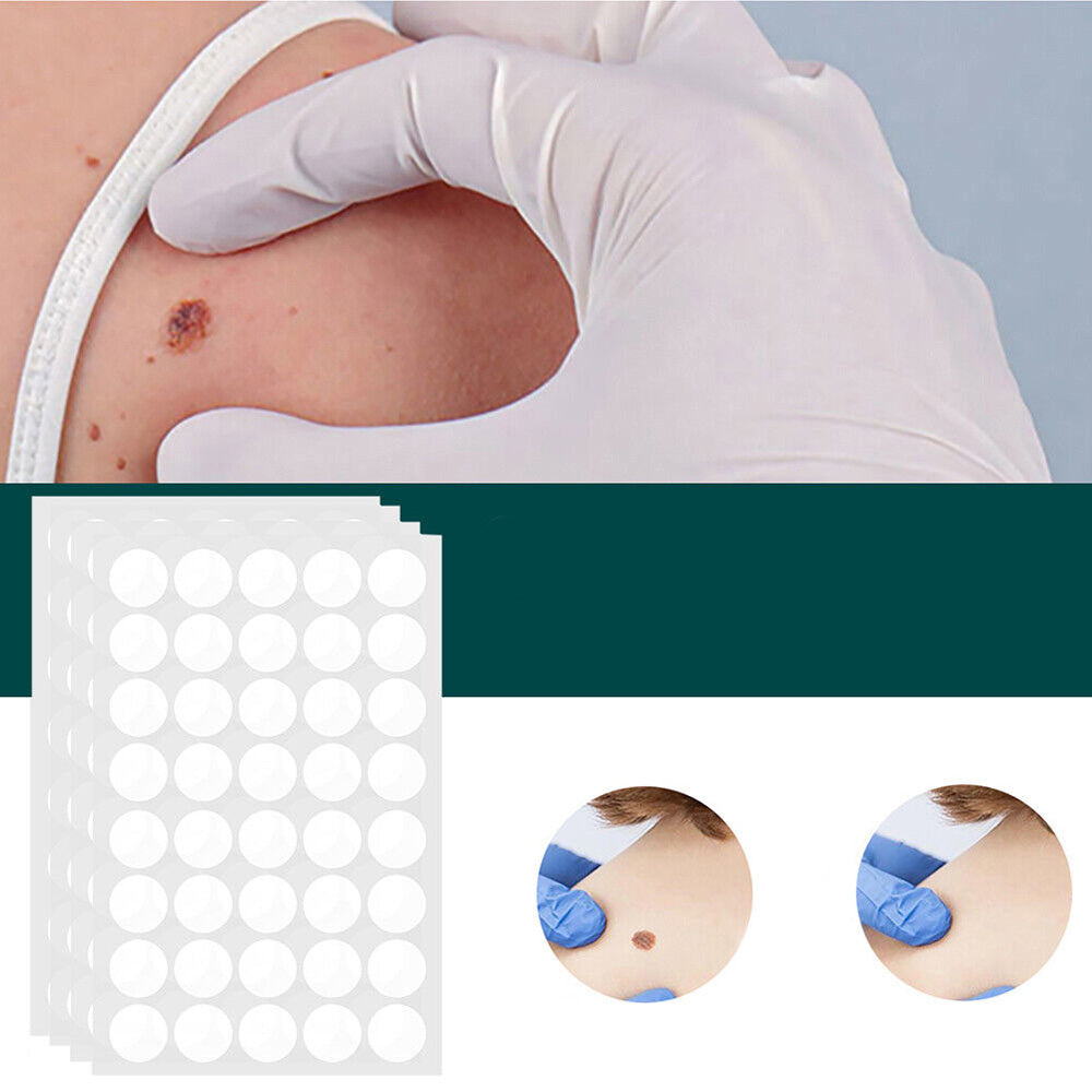 Sisica | SkinClear Skin Tag Remover | Plaster for the Removal of Skin Tags & Warts | Hydrocolloid Technology | Pain-Free & Discreet | Suitable for All Skin Types | 144 Pieces