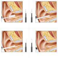 Live Ear Medicinal Ear Endoscope.