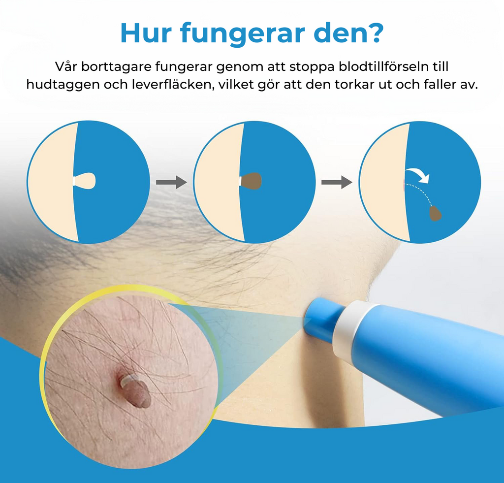 Home Skin Imperfection Remover Kit